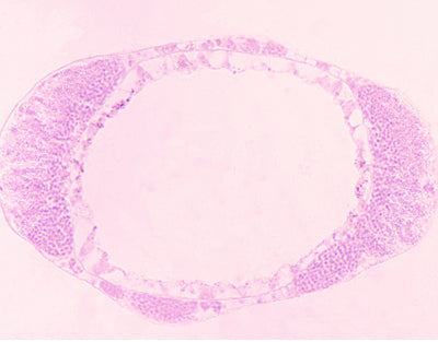 Hydra espermio, s.t.