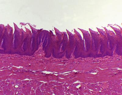 Língua com papilas filiformes, s.l