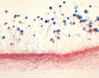 Aspergillus, m.e.