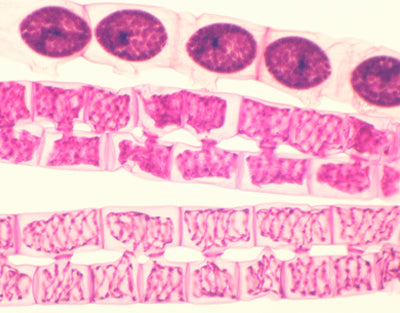 Conjugação de spirogyra, m.e