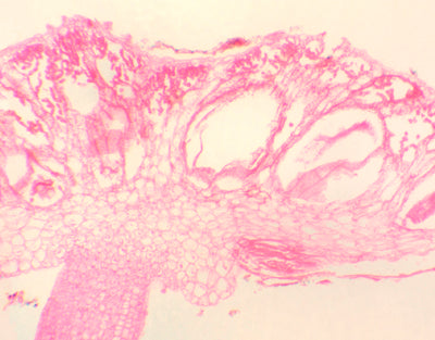 Antheridio de marchantia, s.l