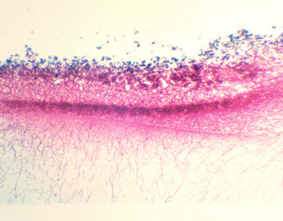 Penicillium, m.e.