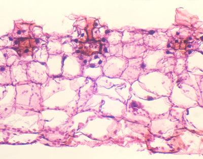 Feto prothallus com arquegónio, s.t