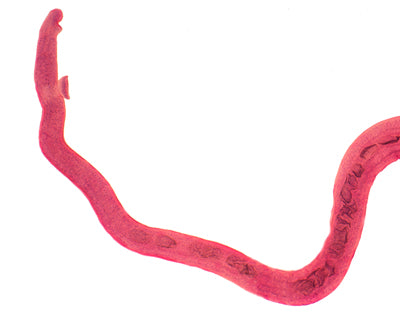 Schistosoma feminino, m.e.