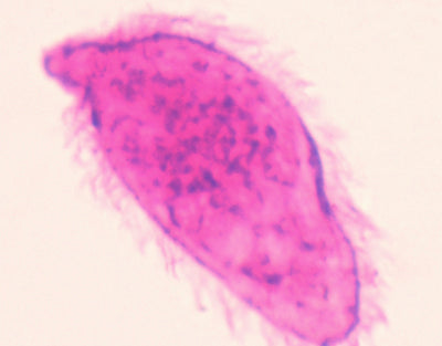 Schistosoma miracidium, m.e.