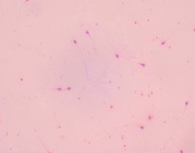 Extensão de esperma humano