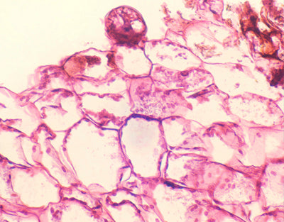 Feto prothallus com anterídio, s.t - NOVEDUC Equipamento Laboratório e Formação Profissional