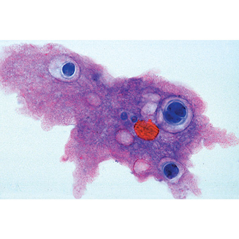 Lâmina Fósseis Foraminiferas Do Giz